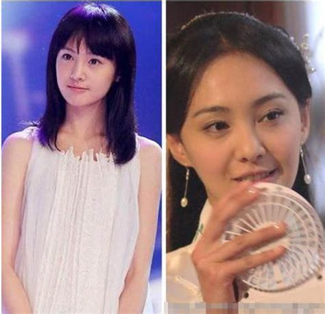 zheng shuang before plastic surgery.